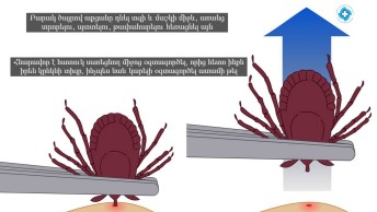 Լայմի հիվանդություն՝ ինչպես խուսափել