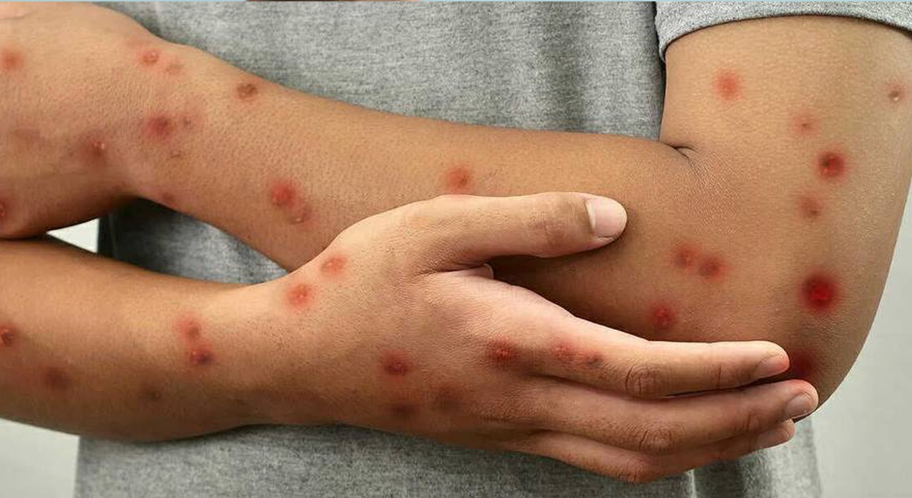 Կապիկի ծաղիկ․ ախտանշաններ և տարածում