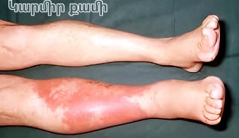 Օգտակար նյութեր