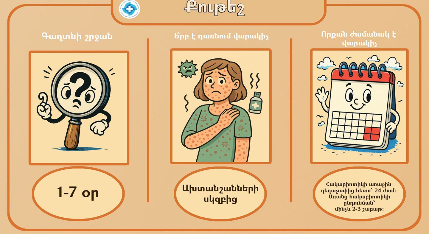 Ինչպիսի՞ հիվանդություն է քութեշը