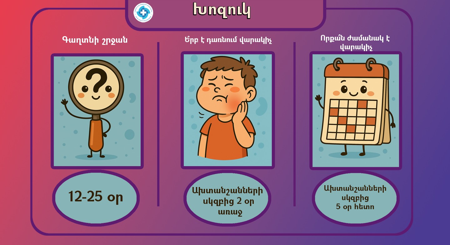 Խոզուկ (Էպիդեմիկ պարոտիտ). որոնք են ախտանշանները