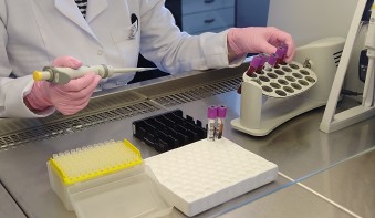 Տուբերկուլոզի IGRA թեստեր ԻՀԱԿ բոլոր հասցեներում