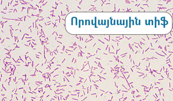 ԻՀԱԿ-ը հաջողությամբ ժամանակին արձագանքել է որովայնային տիֆի՝ Հայաստան բերված դեպքին