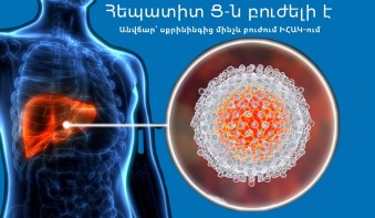Հեպատիտ Ց․ ժամանակին հետազոտվելը կարող է փրկել Ձեր առողջությունը
